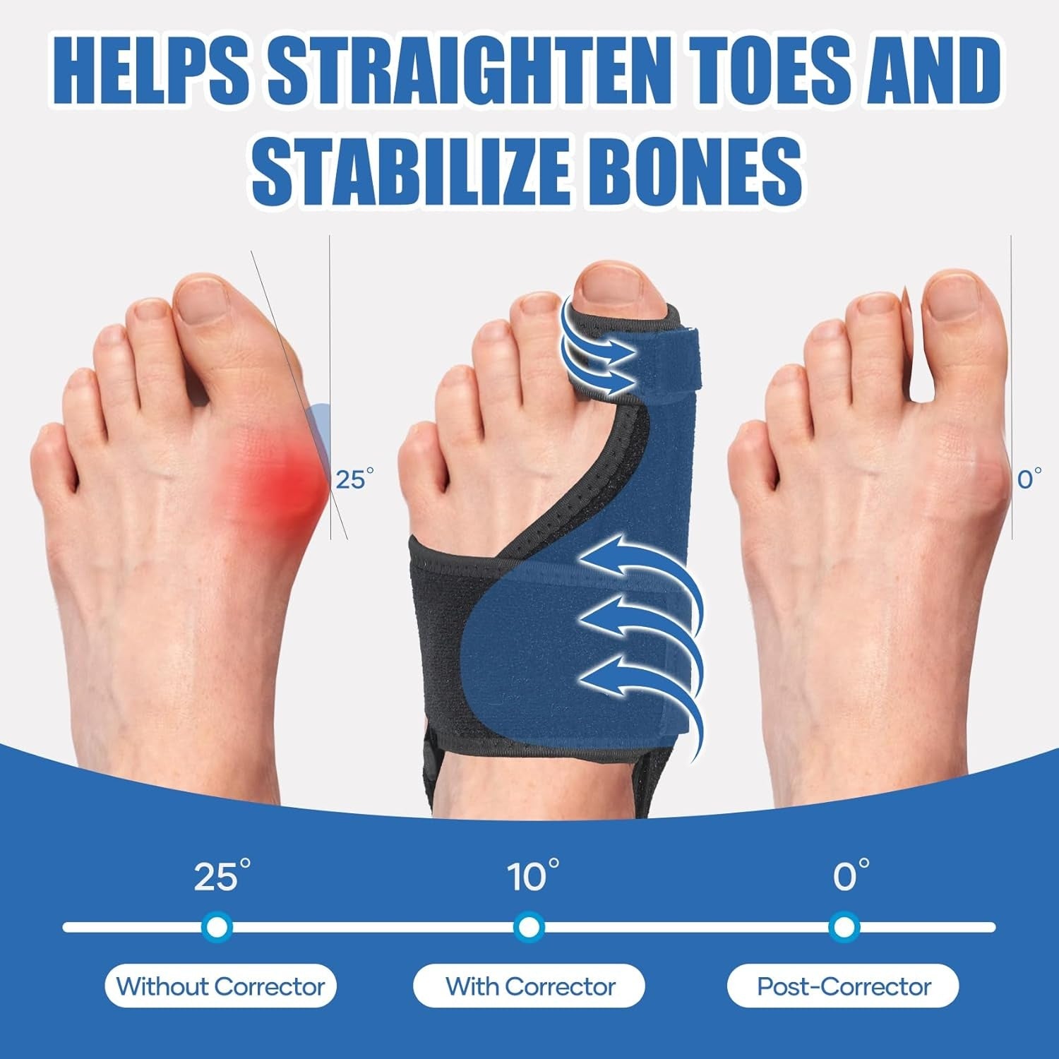 🦶 Neoprene Bunion Toe Corrector - Premium Quality🏆