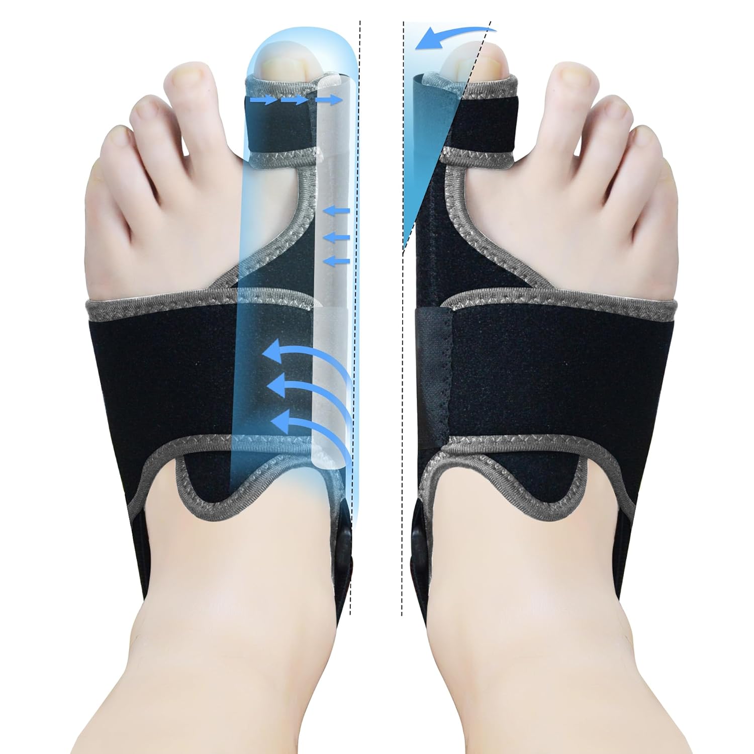 🦶 Neoprene Bunion Toe Corrector - Premium Quality🏆